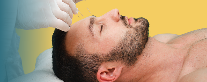 Acupuncteur