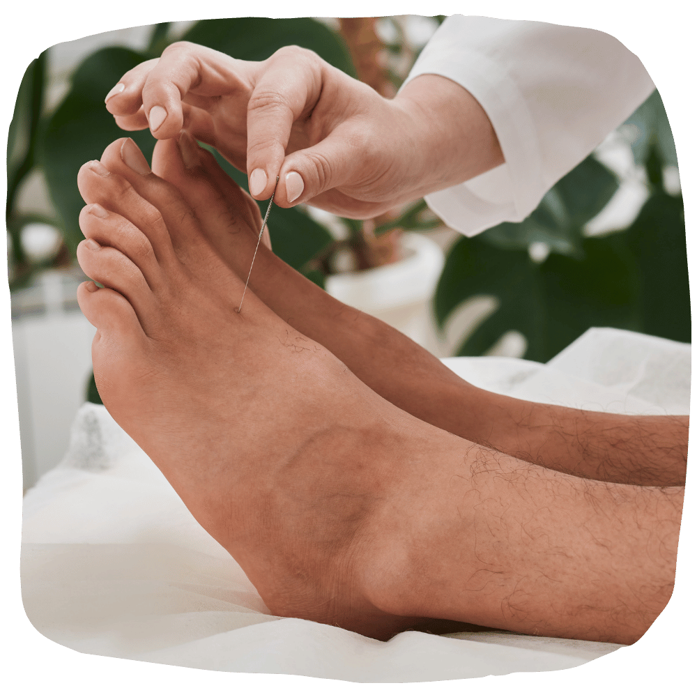 Acupuncteur